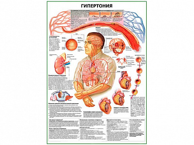 Гипертония плакат глянцевый А1/А2 (глянцевый A2)