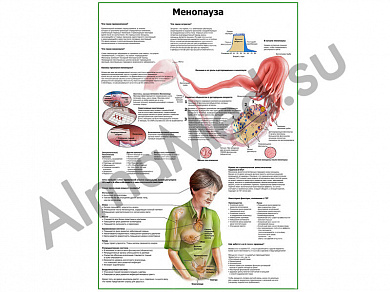 Менопауза плакат ламинированный А1/А2 (ламинированный A2)