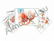 Комплект плакатов для кабинета УЗИ ламинированный А1/А2 (ламинированный	A2)