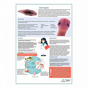 Описторхоз медицинский плакат А1+/A2+ (глянцевая фотобумага от 200 г/кв.м, размер A2+)