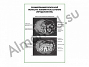 Сканирование брюшной полости: поперечное сечение (продолжение) плакат глянцевый/ламинированный А1/А2 (глянцевый	A2)