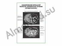 Сканирование брюшной полости: поперечное сечение (продолжение) плакат глянцевый/ламинированный А1/А2 (глянцевый	A2)