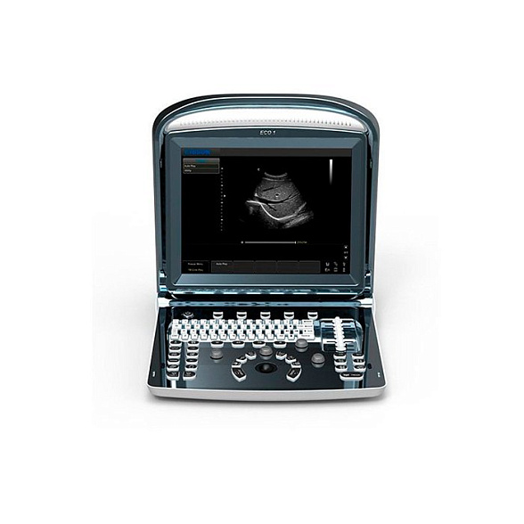 УЗИ сканер SonoTouch 10 Chison