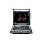 Ультразвуковой сканер S9 SonoScape