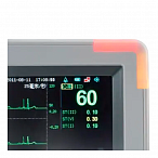Монитор для глубины наркоза G9L, Дания