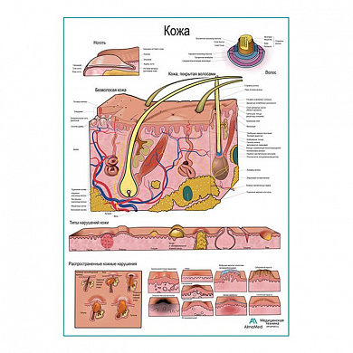 Кожа и типы нарушений, плакат глянцевый  А1+/А2+ (матовый холст от 200 г/кв.м, размер A1+)