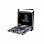 Ультразвуковой сканер S9Pro SonoScape