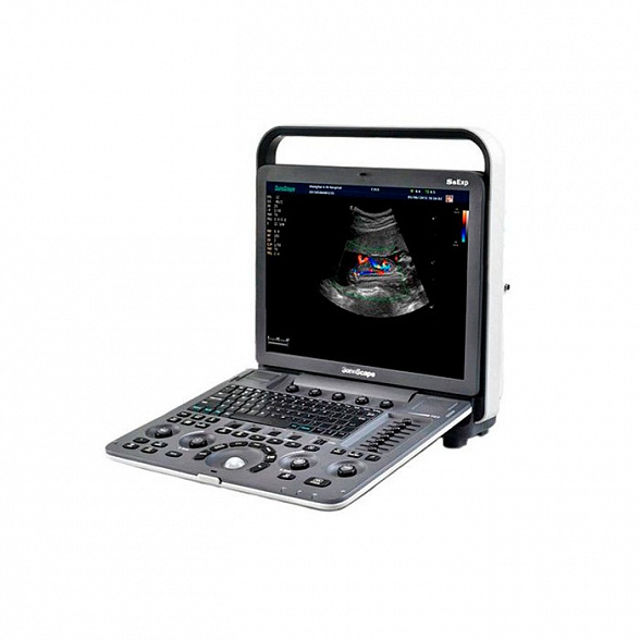 Ультразвуковой сканер S9Pro SonoScape