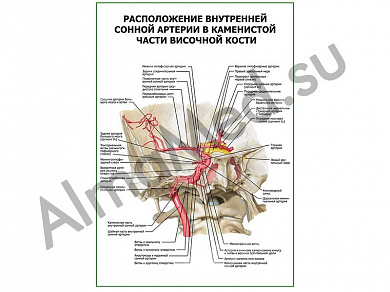 Расположение внутренней сонной артерии в каменистой части височной кости плакат глянцевый/ламинированный А1/А2 (глянцевый	A2)