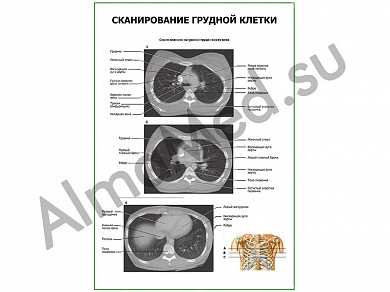 Сканирование грудной клетки плакат ламинированный А1/А2 (ламинированный	A2)