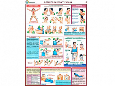 Остановка кровотечения, плакат глянцевый А1/А2 (глянцевый A2)