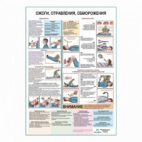 Ожоги, отравления, обморожения, плакат глянцевый А1+/А2+ (матовый холст от 200 г/кв.м, размер A1+)