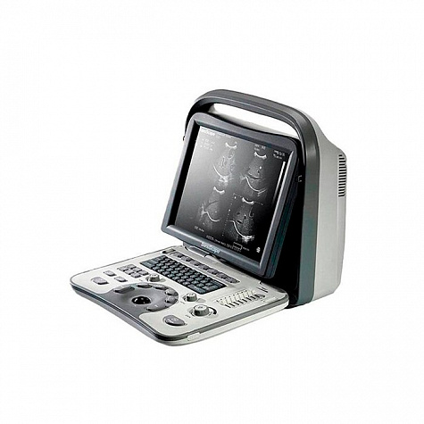 Ультразвуковой сканер A6 SonoScape