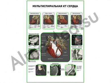 Мультиспиральная КТ Сердца плакат глянцевый/ламинированный А1/А2 (глянцевый	A2)