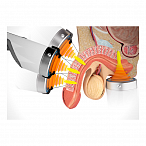 Аппарат ударно-волновой терапии Duolith SD1 T-Top (Ultra)