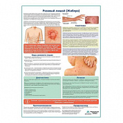 Розовый лишай (Жибера) медицинский плакат А1+/A2+ (глянцевая фотобумага от 200 г/кв.м, размер A2+)