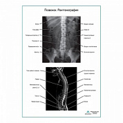 Позвонок. Рентгенография плакат глянцевый  А1+/А2+ (глянцевый холст от 200 г/кв.м, размер A1+)