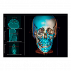 Instrumentarium OP 3D Vision V8 - панорамный томограф