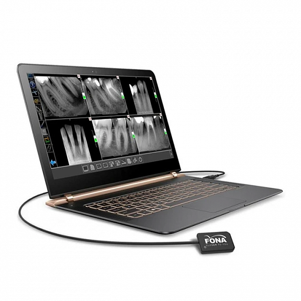 Fona StarX PRO - система интраоральной визиографии