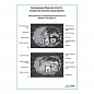 Сканирование брюшной полости: поперечное сечение (продолжение) плакат глянцевый А1+/А2+ (глянцевая фотобумага от 200 г/кв.м, размер A2+)