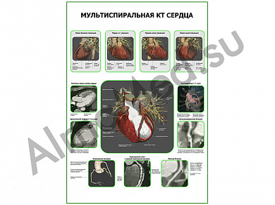 Мультиспиральная КТ Сердца плакат ламинированный А1/А2 (ламинированный	A2)