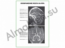 Изображение мозга на МРА плакат глянцевый/ламинированный А1/А2 (глянцевый	A2)