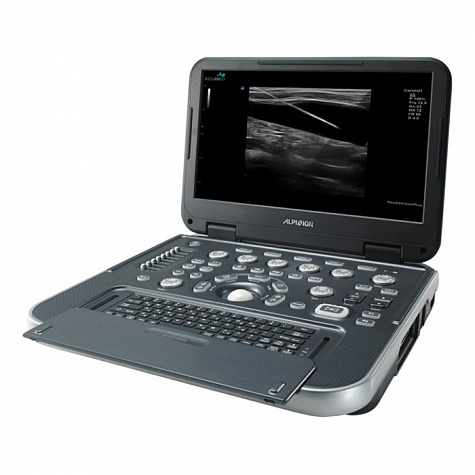 Ультразвуковой сканер E-CUBE i7 Alpinion