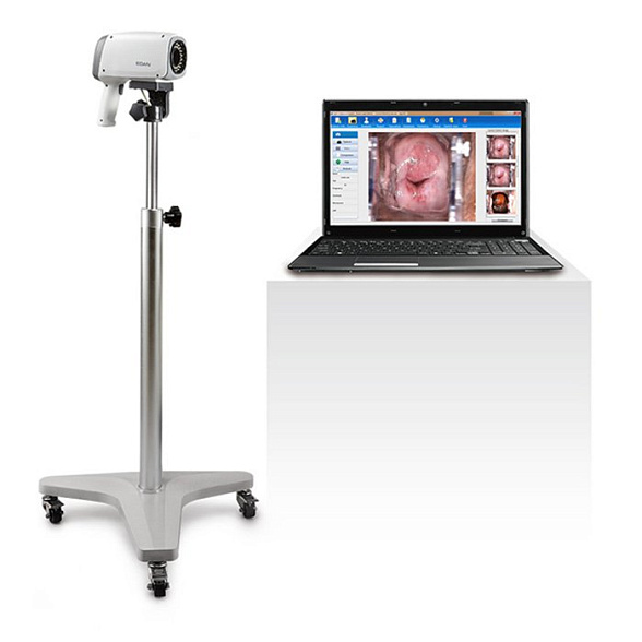 Видеокольпоскопы С6 HD/С6A HD, Edan