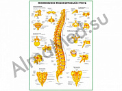 Позвонки и позвоночный столб, плакат ламинированный А1/А2 (ламинированный	A2)