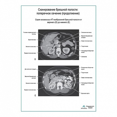 Сканирование брюшной полости: поперечное сечение (продолжение) плакат глянцевый А1+/А2+ (глянцевый холст от 200 г/кв.м, размер A1+)