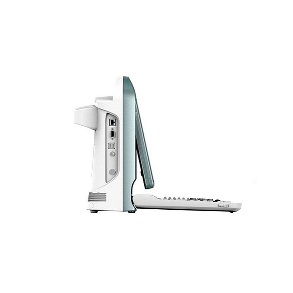 УЗИ сканер SonoTouch 50 Chison