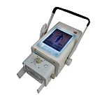 Портативный рентген DS.Xray 2808tb