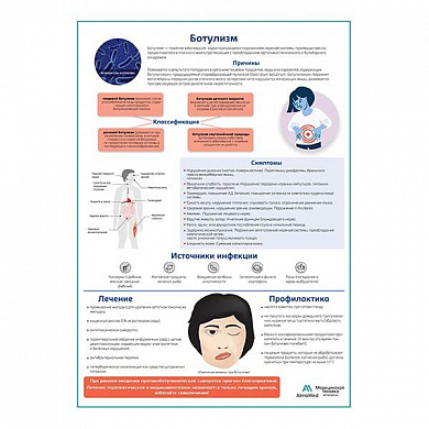 Ботулизм медицинский плакат А1+/A2+ (глянцевая фотобумага от 200 г/кв.м, размер A2+)