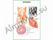 Аппендикс плакат ламинированный А1/А2 (ламинированный	A2)