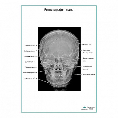 Рентгенография черепа плакат глянцевый А1+/А2+ (глянцевая фотобумага от 200 г/кв.м, размер A1+)