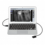 New Life Radiology Mercury DIGISENS - цифровой радиовизиограф