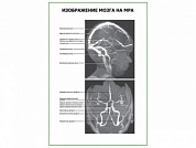 Изображение мозга на МРА плакат глянцевый А1/А2 (глянцевый A2)