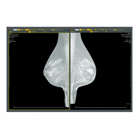 Аппаратно-программный комплекс «ДИАРМ-МТ-Плюс»