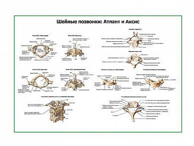 Шейные позвонки и их соединения плакат глянцевый А1/А2 (глянцевый A1)