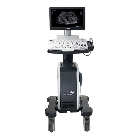 Ультразвуковой сканер E-CUBE 5 Alpinion