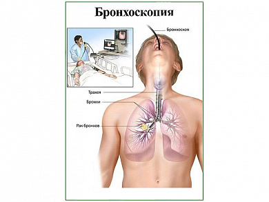 Бронхоскопия, плакат глянцевый/ламинированный А1/А2 (глянцевый	A2)