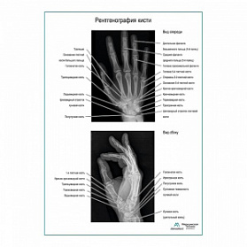 Рентгенография кисти плакат глянцевый А1+/А2+ (матовый холст от 200 г/кв.м, размер A1+)