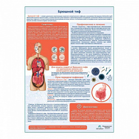 Брюшной тиф медицинский плакат А1+/A2+ (глянцевая фотобумага от 200 г/кв.м, размер A2+) Брюшной тиф медицинский плакат А1+/A2+ (глянцевая фотобумага от 200 г/кв.м, размер A2+)