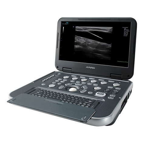 Ультразвуковой сканер E-CUBE i7 Alpinion