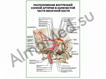 Расположение внутренней сонной артерии в каменистой части височной кости плакат ламинированный А1/А2 (ламинированный	A2)