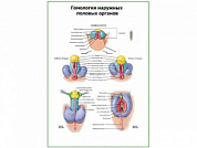Гомология наружных половых органов плакат глянцевый А1/А2 (глянцевый A1)