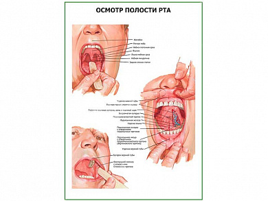 Осмотр полости рта плакат глянцевый А1/А2 (глянцевый A1)