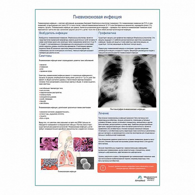 Пневмококковая инфекция медицинский плакат А1+/A2+ (глянцевая фотобумага от 200 г/кв.м, размер A2+)