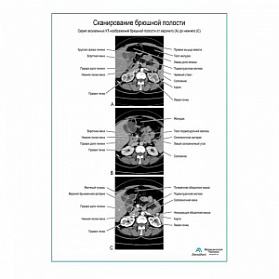 Сканирование брюшной полости плакат глянцевый  А1+/А2+ (глянцевый холст от 200 г/кв.м, размер A1+)