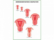 Возрастные изменения матки плакат глянцевый  А1/А2 (глянцевый A2)